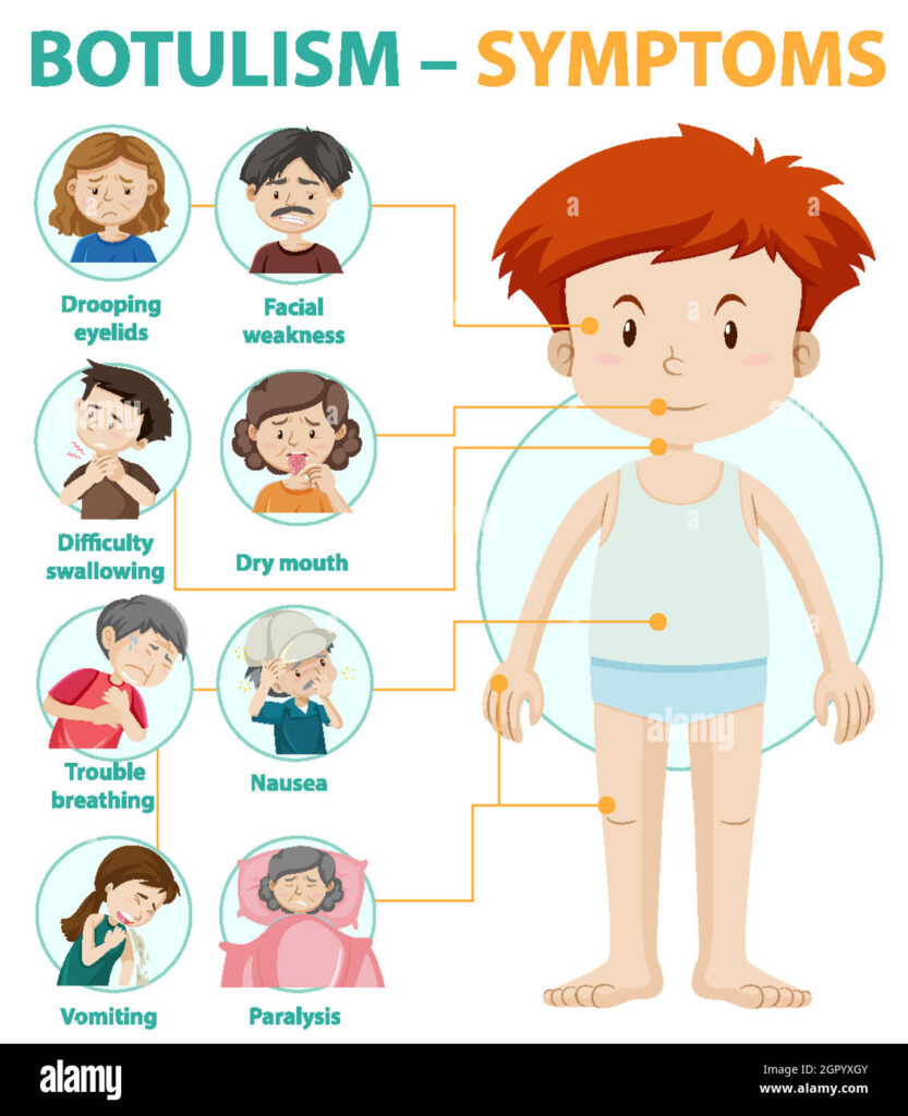 Botulism Toxin